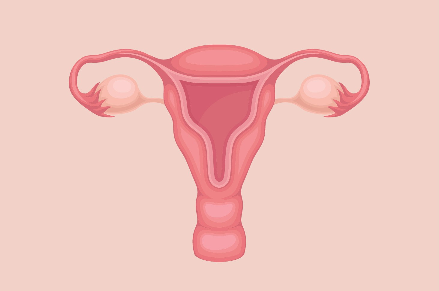 Uterus merupakan organ reproduksi wanita yang berfungsi sebagai